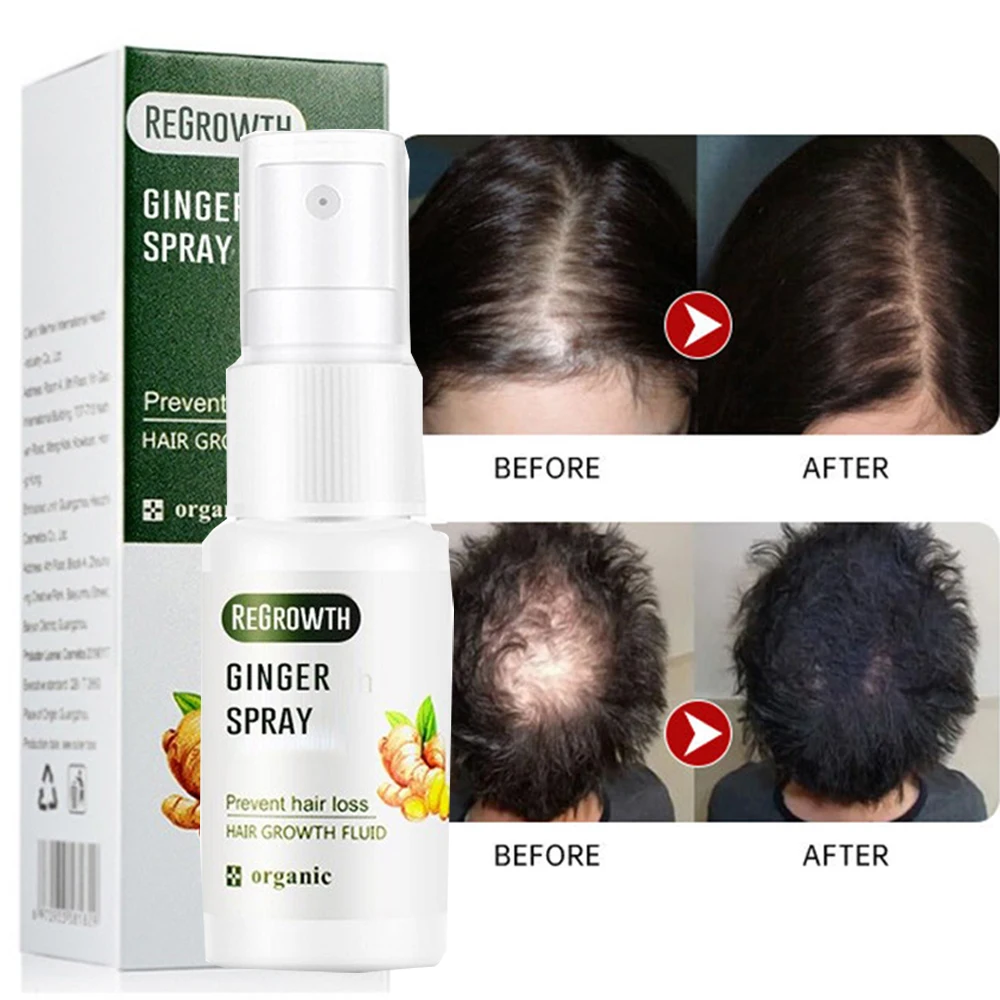 

Ginger Hair Growth Spray Prevent Hair Loss Products Restore Hair Root Repair Damaged Nourishing Scalp Treatment Hair Growth Care