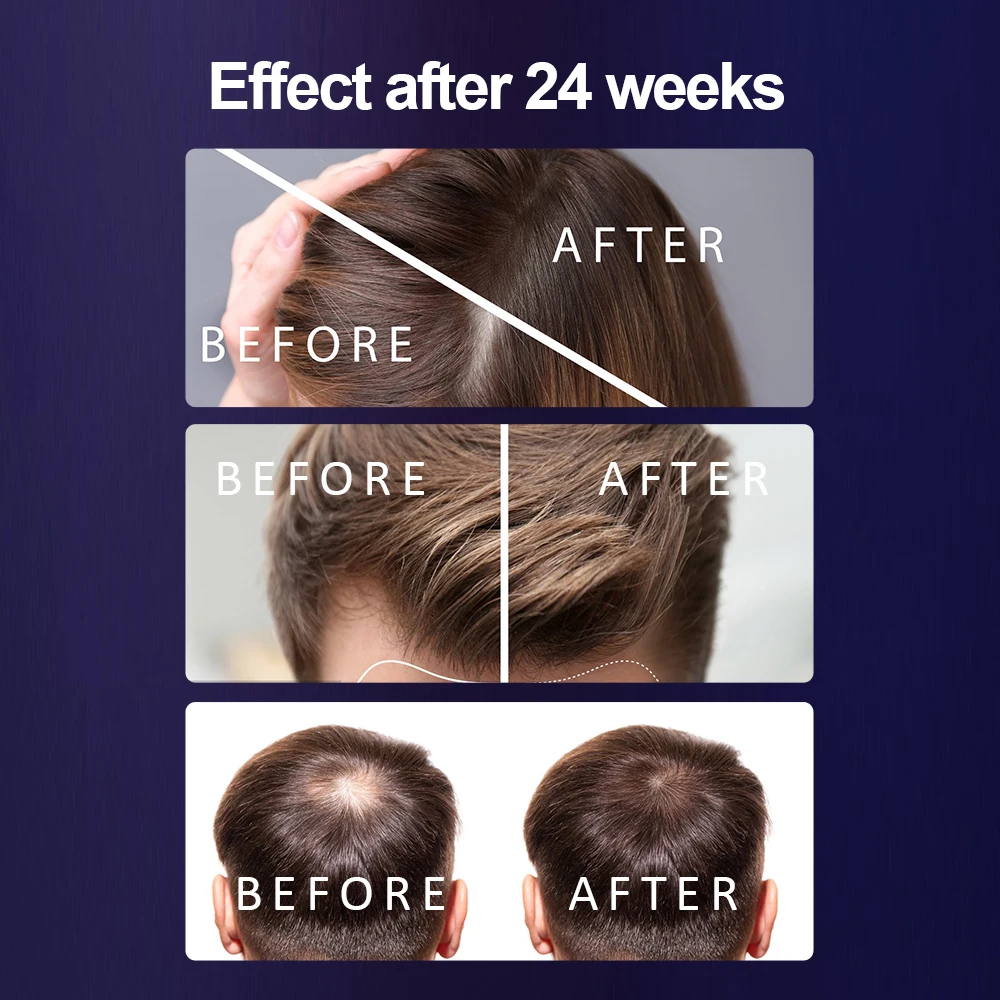 108 шт. головной убор для роста волос