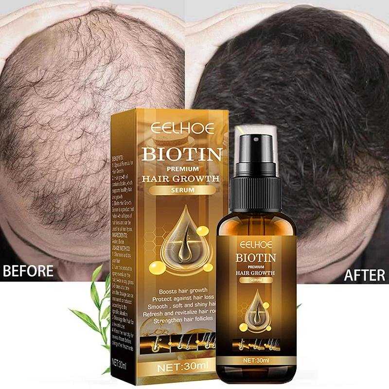 

7Days Ginger Hair Growth Products Natural Anti Hair Loss Prevent Baldness Treatment Fast Growing Nourish Dry Damaged Hair Care