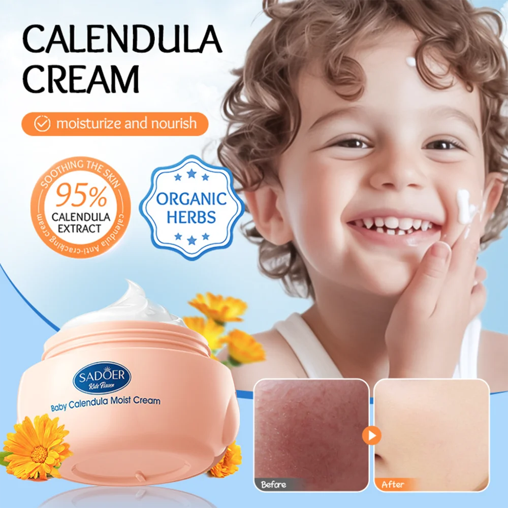 Детский крем-календула для лица Cremas Faciales Crema Aclarante De Piel Hidratante Para El Rostro Crème Eclaircissante