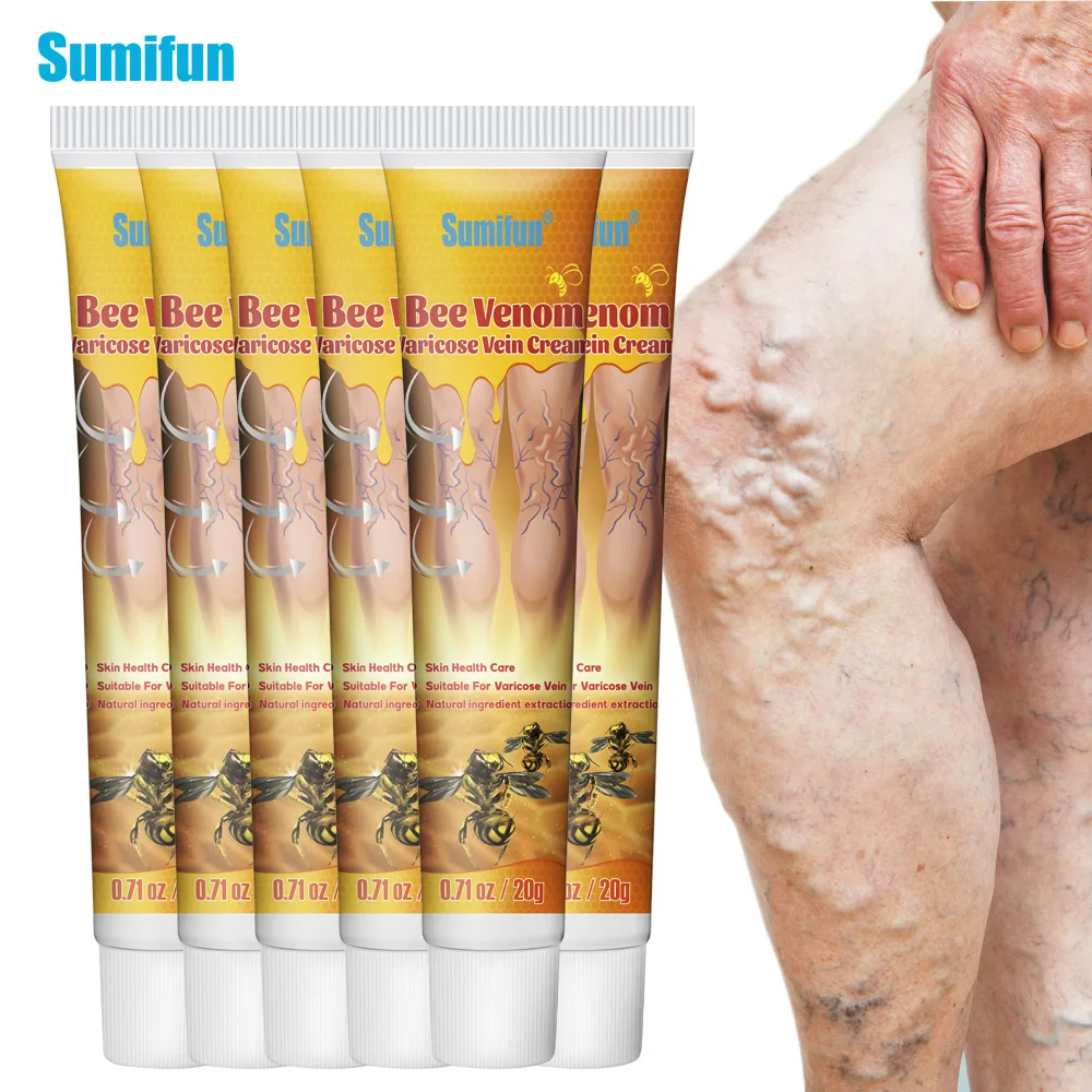 1/3/5/7/10/50 шт. Sumifun крем для лечения варикозного расширения вен васкулит флебит