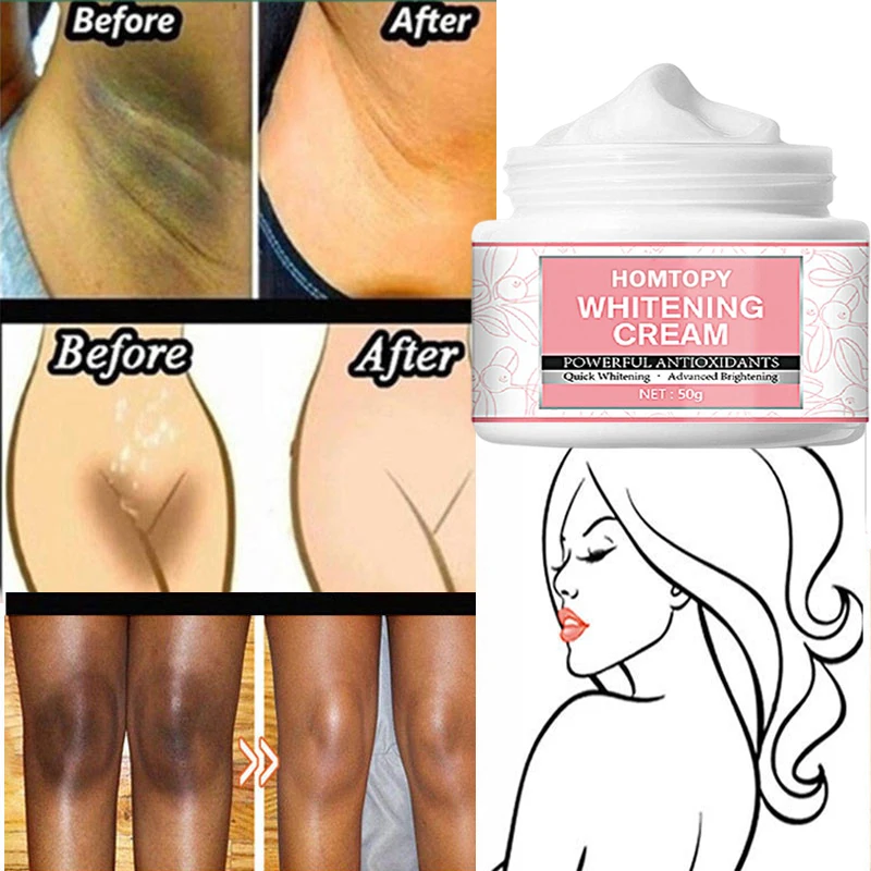 

Private Parts Whitening Body Cream Whiten Armpits Ankles Elbows Knees Remove Melanin Improve Dullness Brighten Skin Care Product
