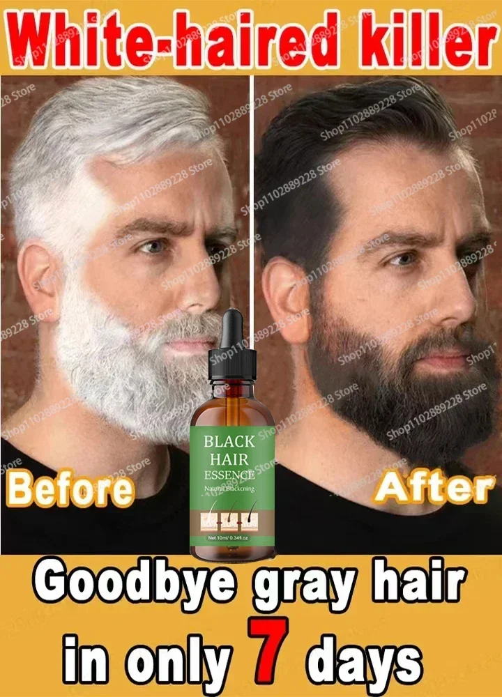Сыворотка для волос с эссенцией против седых Get Rid of White Hair Repair Care Питает кожу