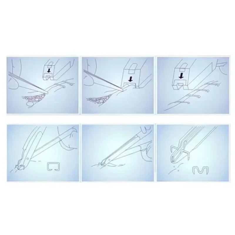 Одноразовый хирургический степлер ument высококачественный медицинский