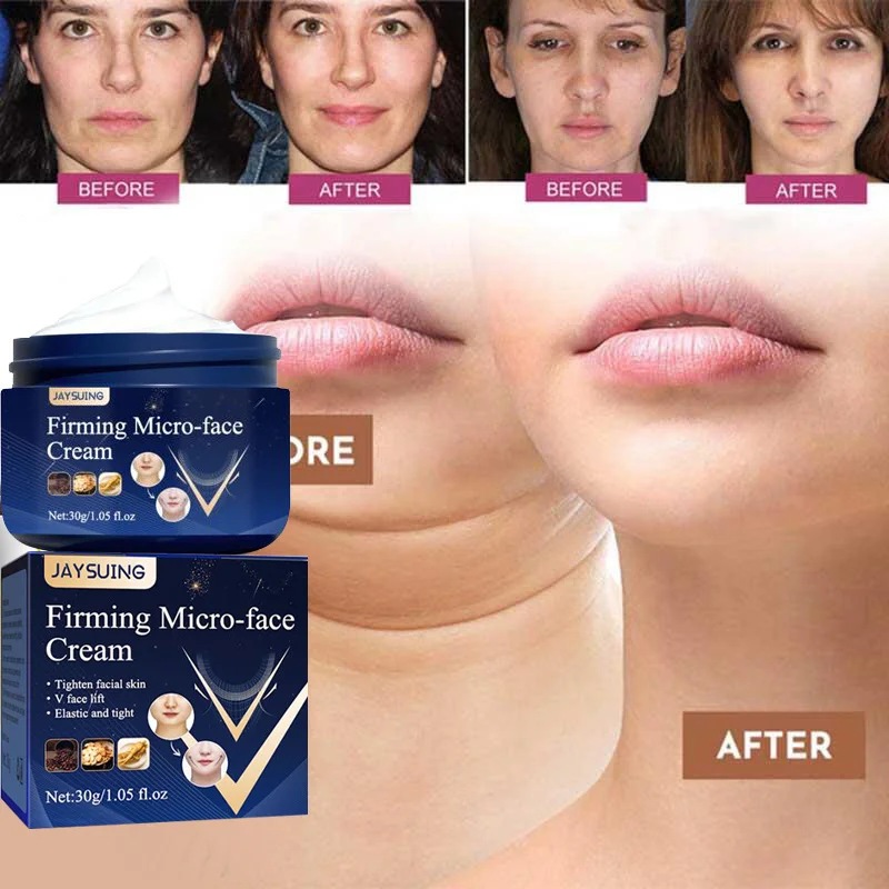 

V-Shape Face Slimming Cream Lifting Firming V Double Chin Cheek Anti Aging Remove Wrinkle Creams Korea Skin Care Cosmetic 30ml