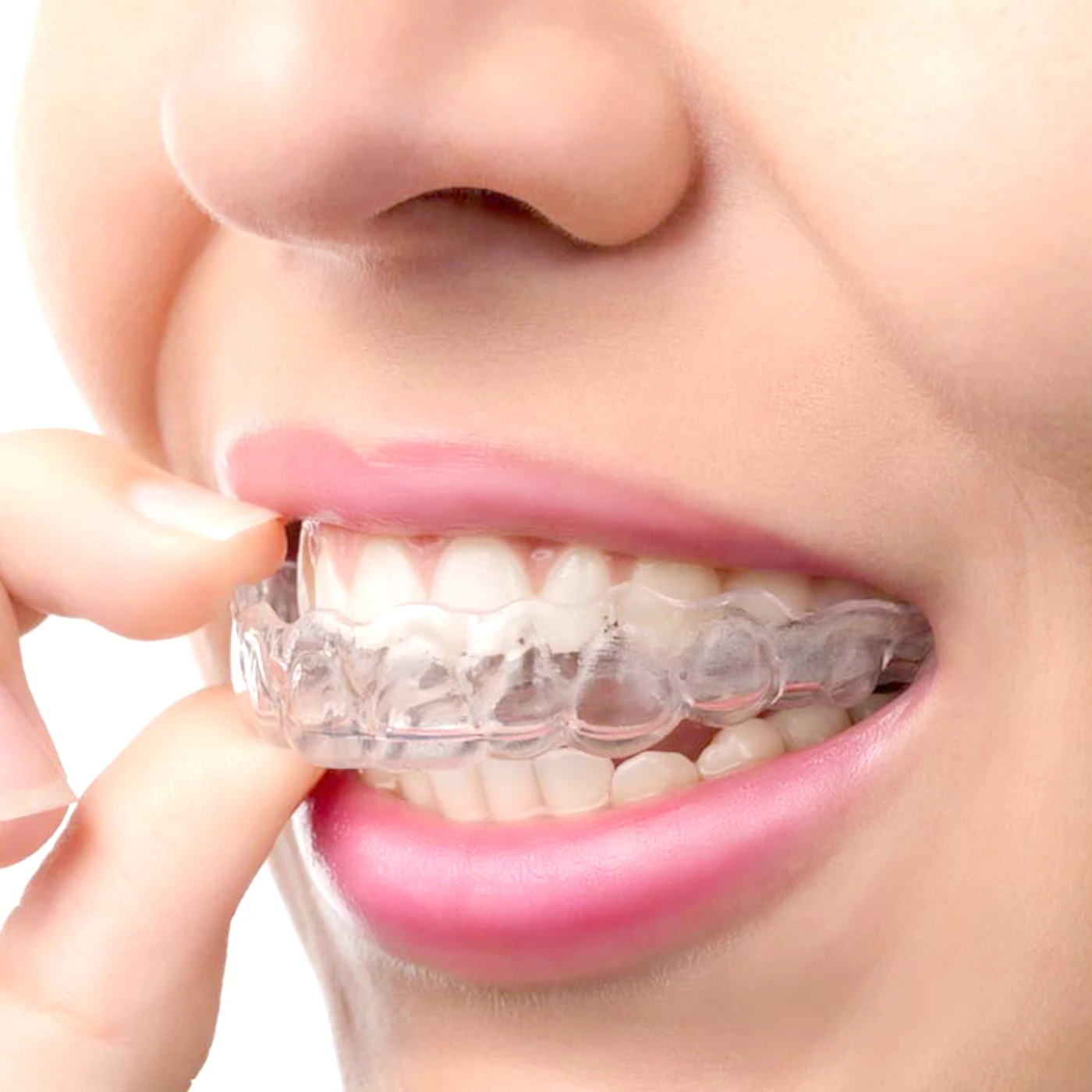 

Bruxism Mouth Guard Sleeping Anti Snore Mouthpiece Homemade Heat Curing Thermoforming Teeth Whitening Braces Anti Clench Grinde