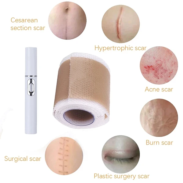 Лазерная ручка для лечения морщин и варикозного расширения вен |