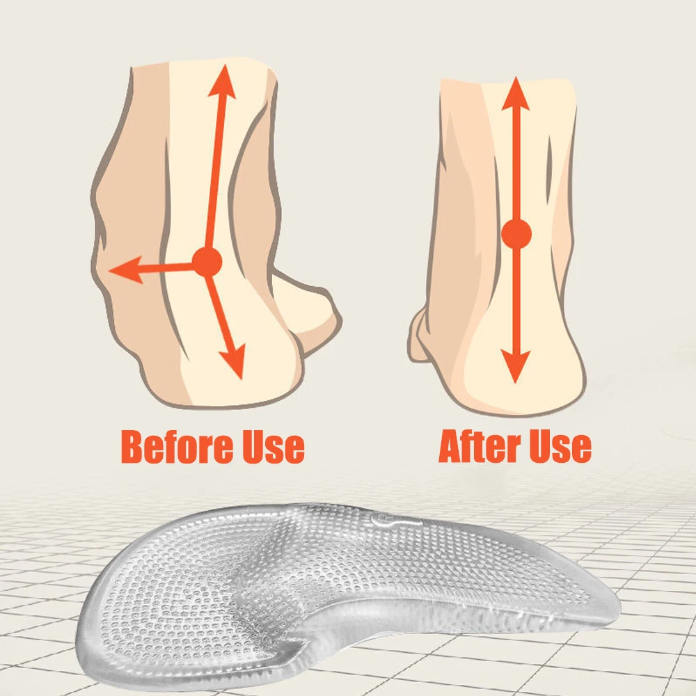 Silicone Orthopedic Insoles for Shoes Women Men Arch Support Gel Insoles for Flat Feet Plantar Faciitis Pain Relief Shoe Pads