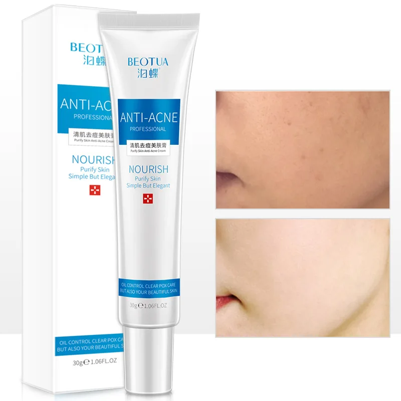 

Acne Cream Anti-acne Water-oil Balance Anti-acne Cream Moisturizing Blemish Cream Beauty Cream Women Makeup