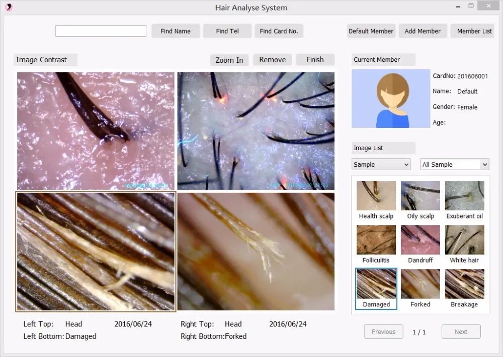 Анализатор диагностики иррископа кожи волос с анализами + ириса все в 1 машине