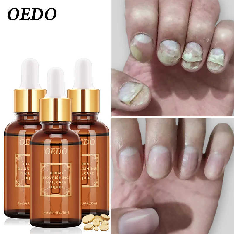 

3 шт., Гель-лак для ногтей, с эфирным маслом