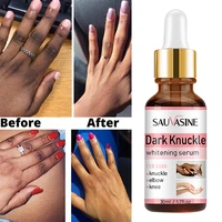30ml hand dark knuckle whitening serum lighten melanin reduce knee elbow dullness skin brightening bleaching essence skin care