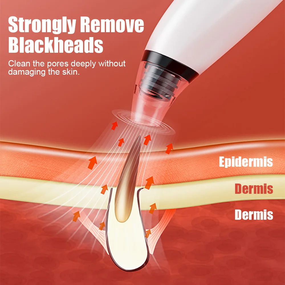 Электрический пылесос для удаления черных точек и акне прибор очищения пор