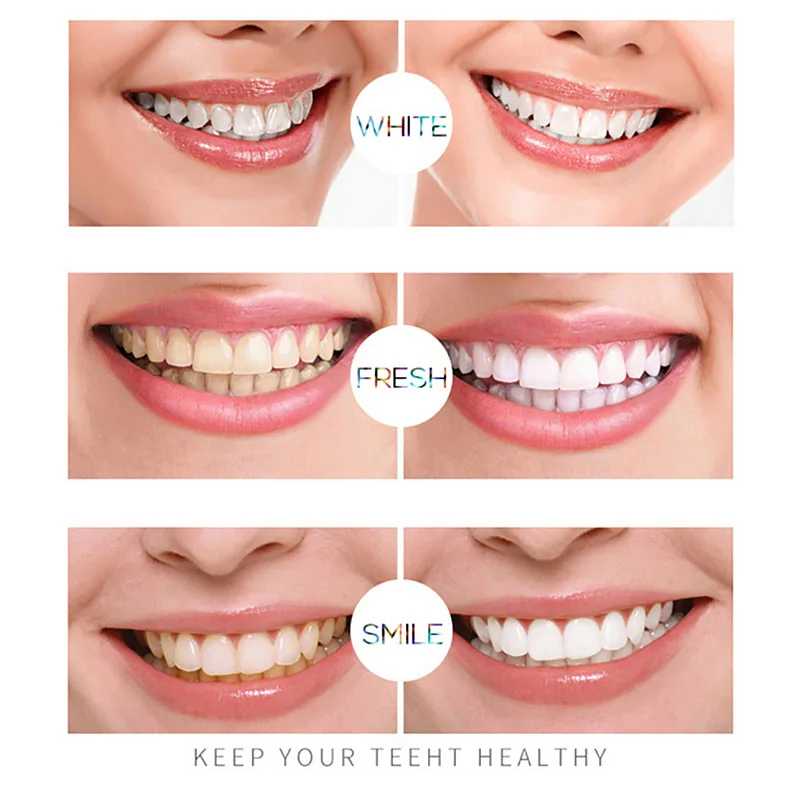 Ручка для отбеливания зубов гель бриллиантовые пятна гигиена полости рта