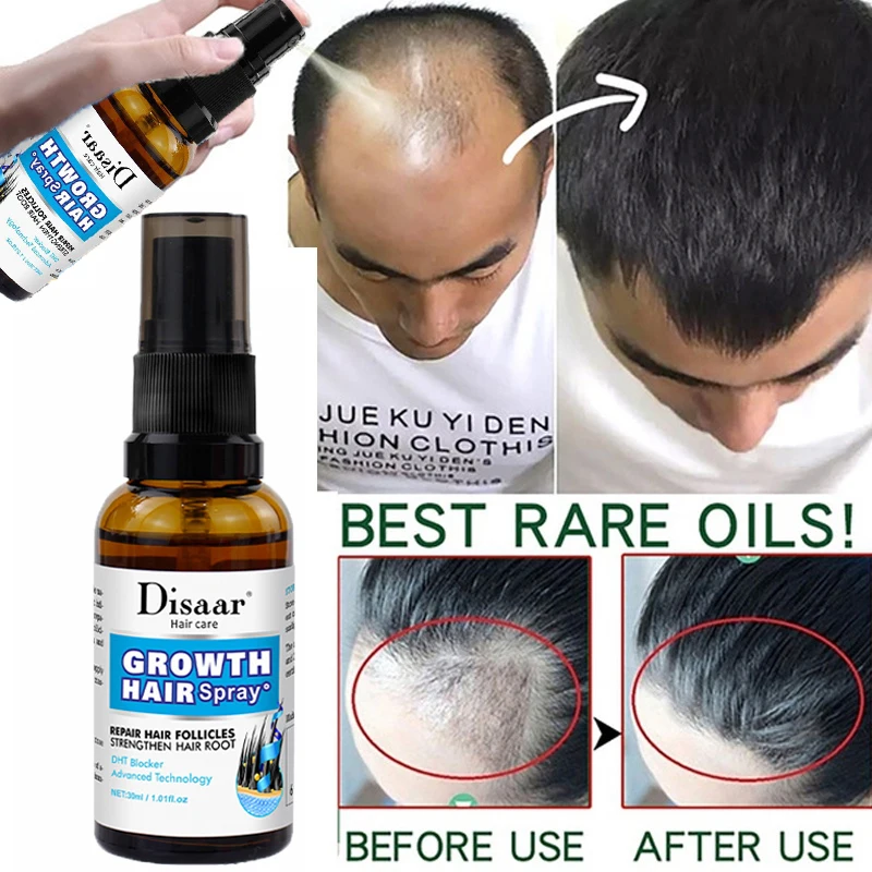 

Hair Growth Serum Spray Fast Hair Growth Liquid Treatment Scalp Hair Follicle Anti Hair Loss Nourish Damaged Beauty Hair Care