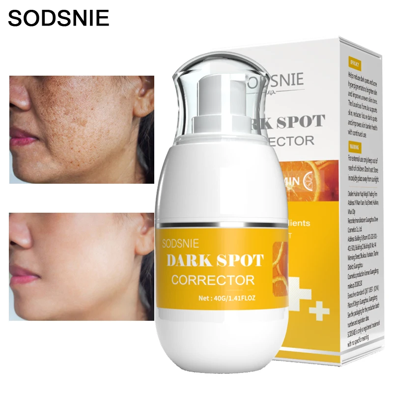 

Dark Spot Corrector Effectively Removes Chloasma Age Spots Sunburn Brightening Improving Dullness Vitamin C Skin Care 40G