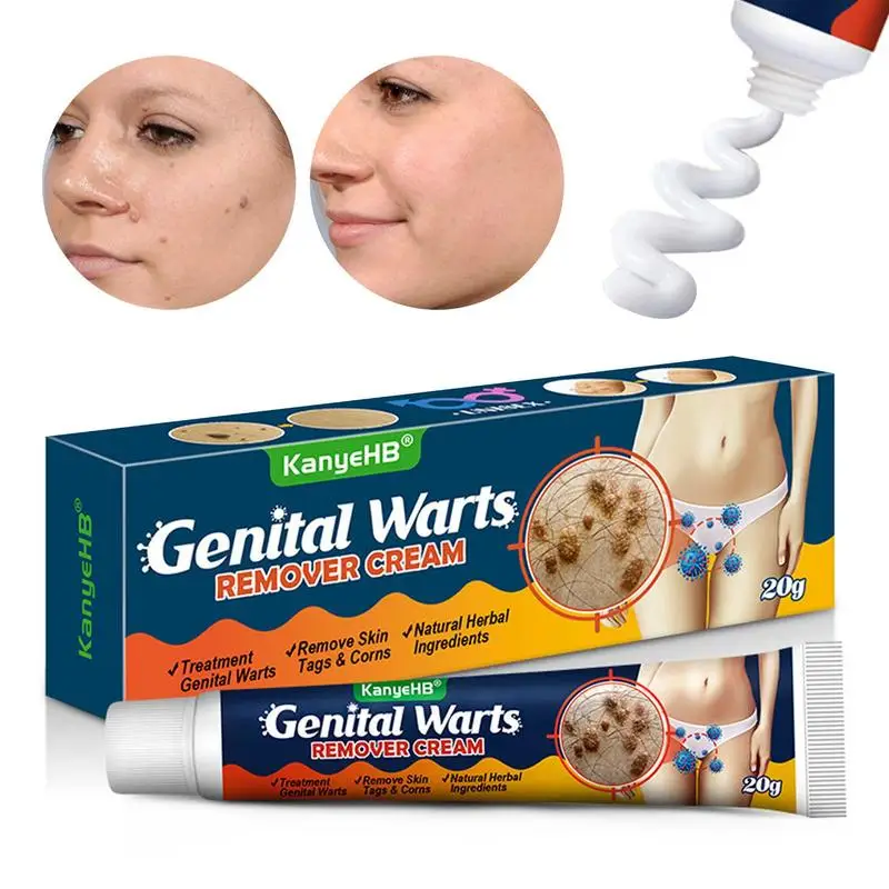 

Genital Tags Remover Cream 20g Skin Tags Removal Ointment Natural Herbal Acuminatum Care Cream Safe Effective Cream For All Skin