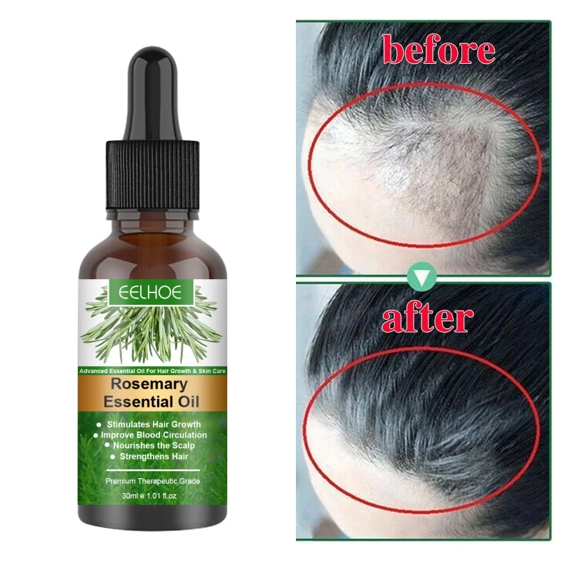 

Rosemary Hair Care Oil Hair Growth Serum Anti Hair Loss HairRoots Regrowth Scalp Treatment Damaged Repair Nourish For Men Women