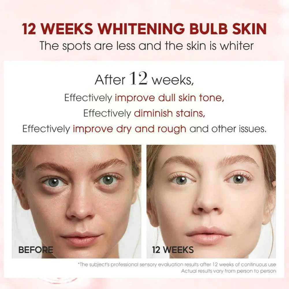 

Nicotinamide Whitening Cream 30g Face Cream Moisturizing Cream Pore Cream Scar Shrinkage Female Acne Skin Care Removal U5H1