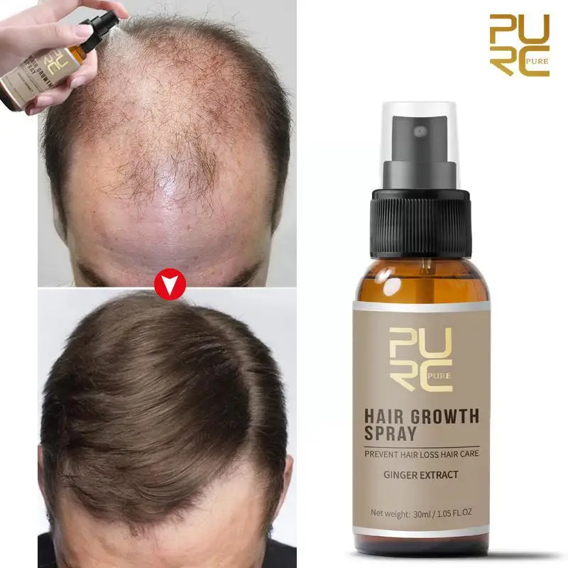 

PURC Ginger Products For Men Anti Hair Loss Oil 7 Days Fast Growing Scalp Treatment Hair Care 20ML M8L3
