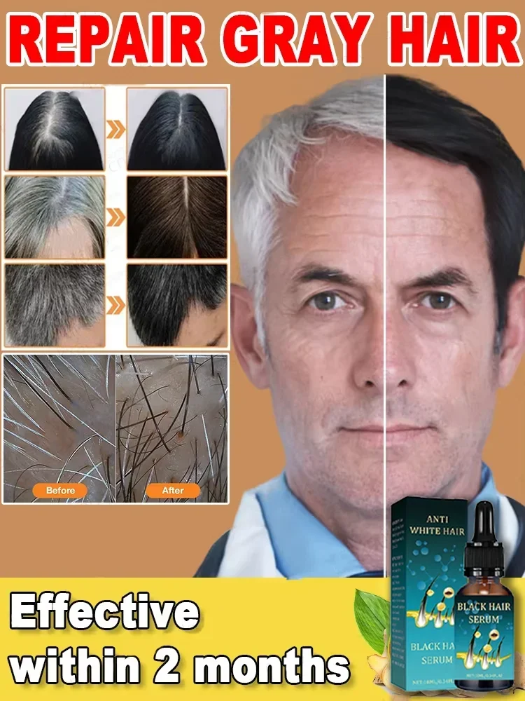 Натуральная сыворотка для волос против седых — восстанавливает белые и