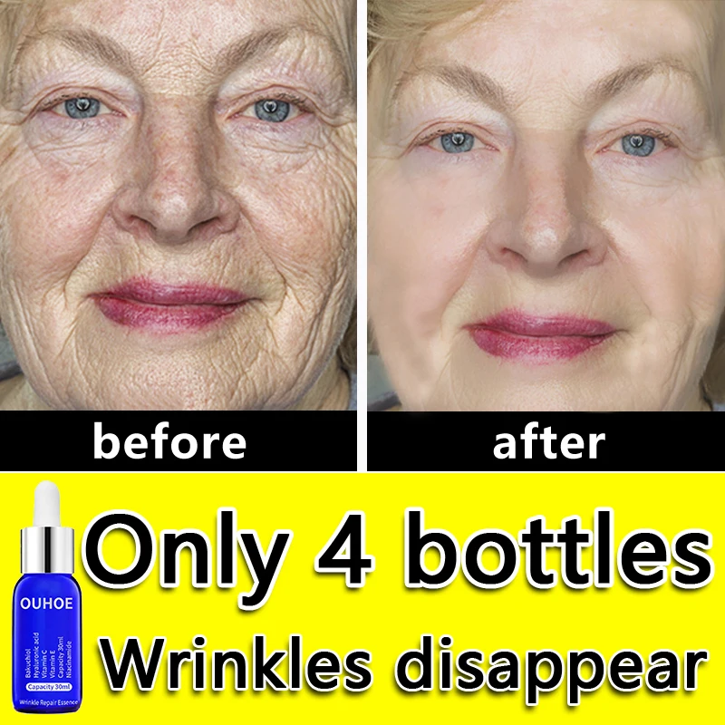 Instant Wrinkle Remover Face Serum Lifting Firming Fade Eye Fine Lines Anti-aging Essence Whitening Brighten Nourish Skin Care
