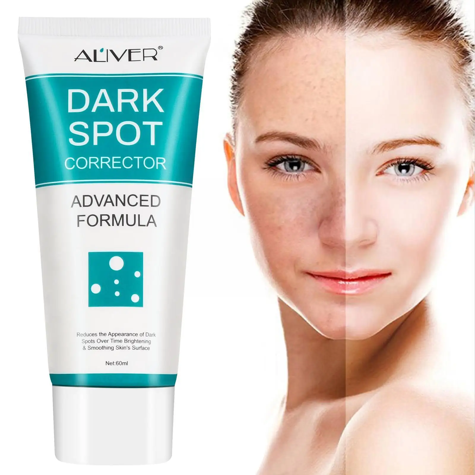

IBeaLee Whitening Freckles Cream Remove Melasma Dark Skin Brightening Care Remover 60ml Lighten Moisturizing Spots U0Z3