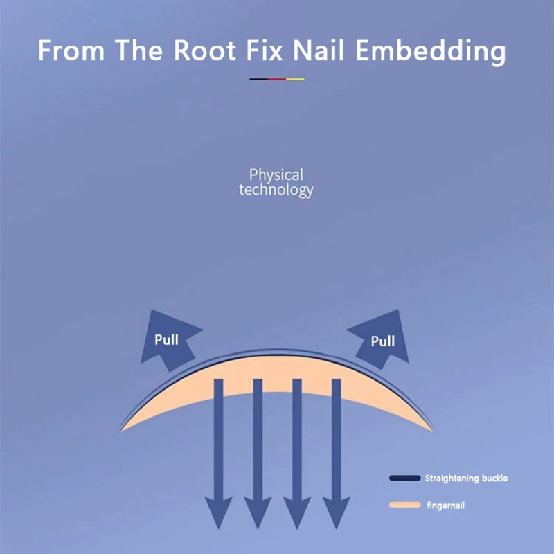 Средство для восстановления вросшей зоны ног инструмент ухода за ногтями