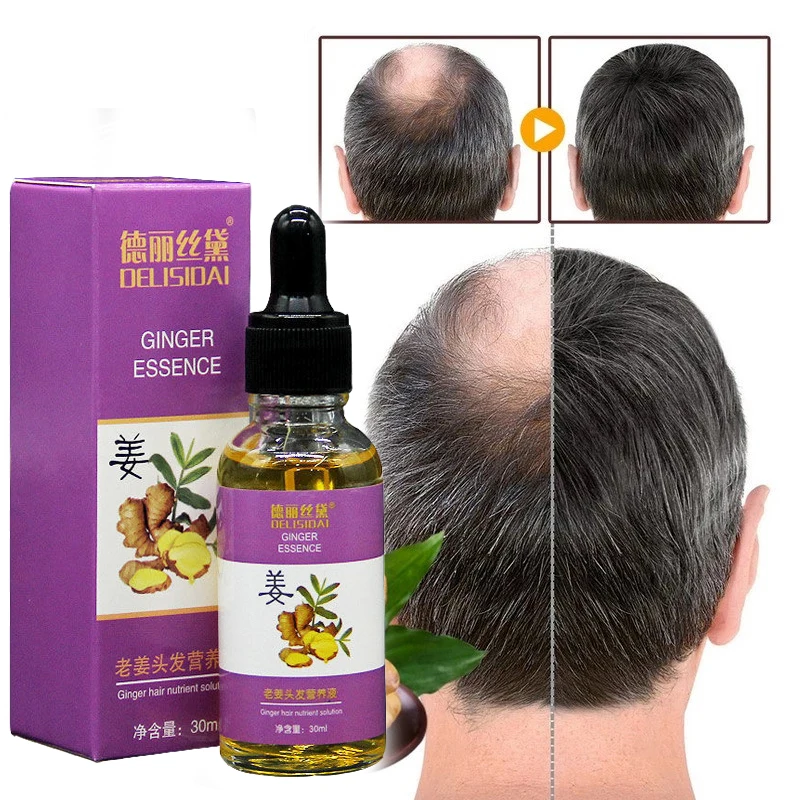 

30ml Hair Growth Products Ginger Fast Growing Hair Essential Oil Beauty Hair Care Prevent Hair Loss Oil Scalp Treatment