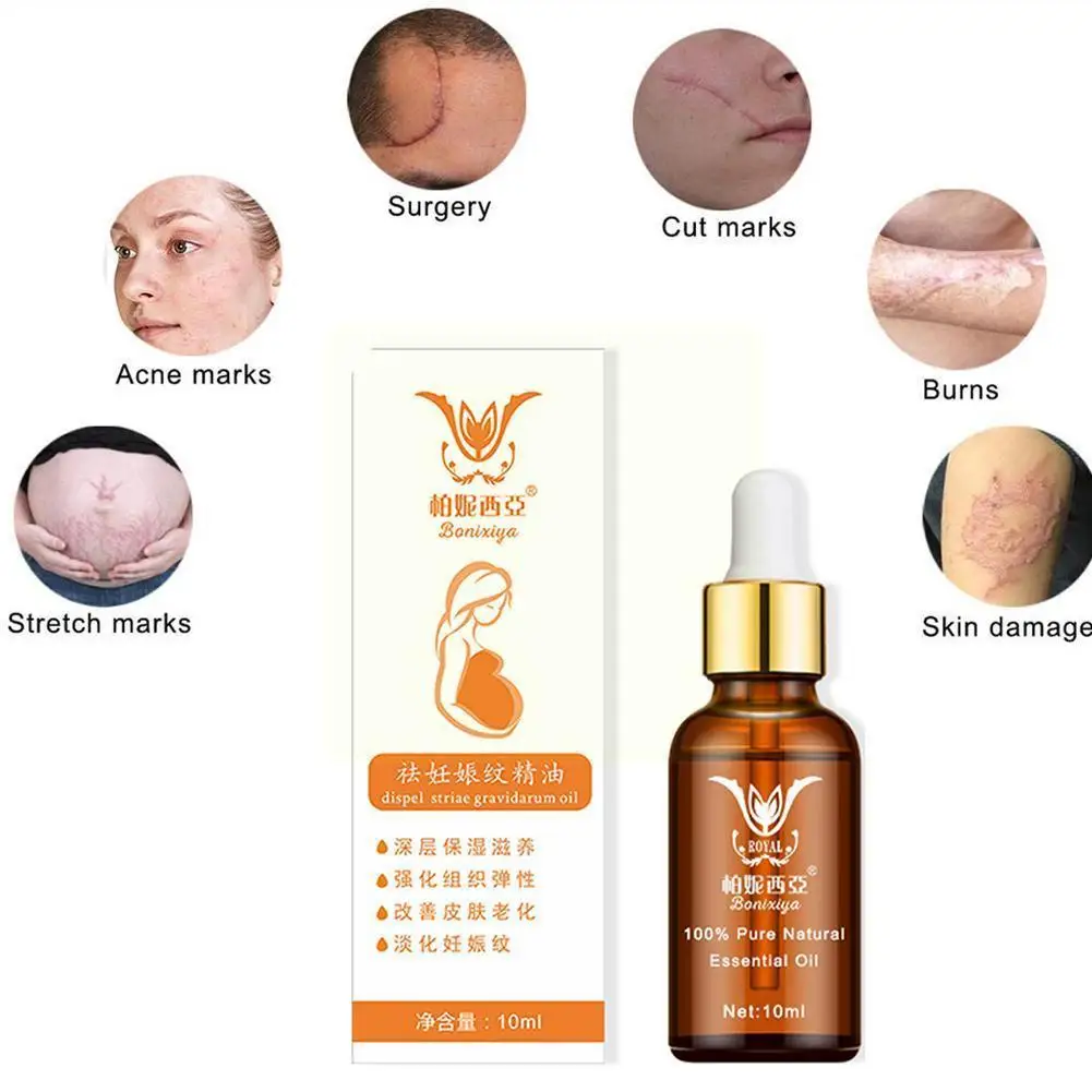 

Stretch Marks Remover Essential Oil Natural Safety Treatment Cream For Stretch Mark Removal Maternity Slackline Skin Care 1 O2b7