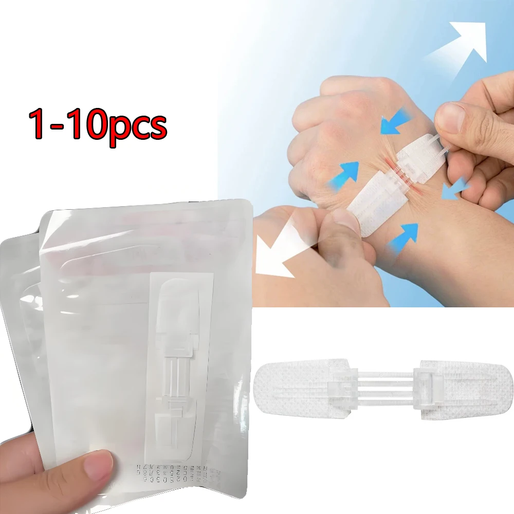 Фото 1-10 шт. Пластырь-застежка для закрытия ран без швов, безболезненный, для перевязки ран, заменитель швов, бандаж-фиксатор №1