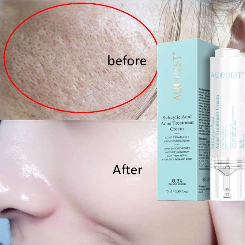 

Salicylic Acid Shrink Pores Face Serum Anti-acne Remove Blackheads Oil Control Moisturizing Essence Nourish Skin Care Lotion