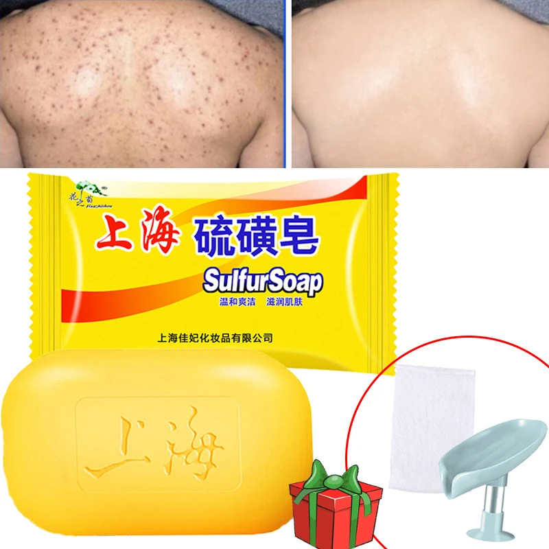 

85g Shanghai Sulfur Bath Soap Oil-Control Acne Eczema Anti Fungus Soaps Cheap Facial Whitening Aloe Vera Cleansing Soaps