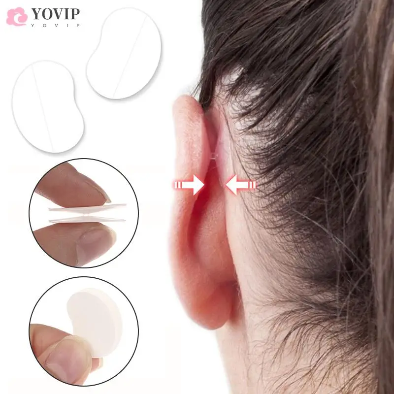 

1/3 шт., невидимая наклейка для коррекции выступающих ушей