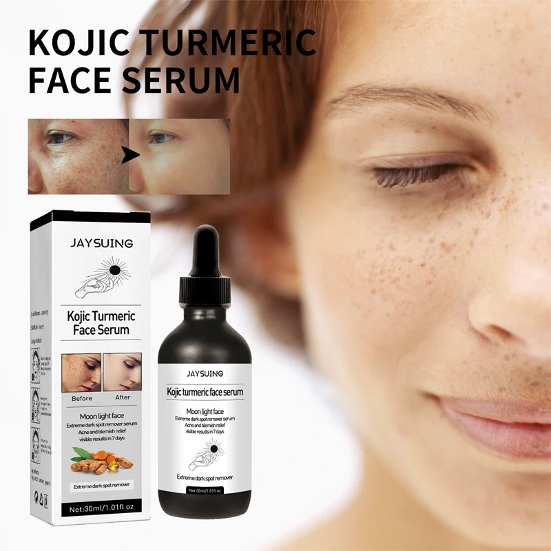 

Turmeric Whitening Freckle Face Serum Removal Melasma Acne Dark Spots Fade Pigment Melanin Corrector Moisturizing Skin Care 30ml
