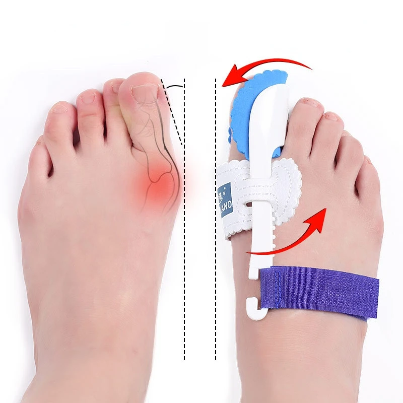 Hallux Valgus Correction Apparatus Thumb Correction Night Use Foot Bone Big Toe Correction Correction Toe Fixation Soothing
