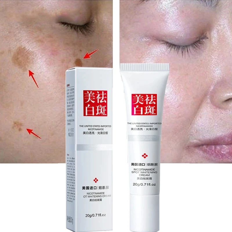 Отбеливающий крем Niacinamide с витамином E выцветает веснушки темные пятна для лица