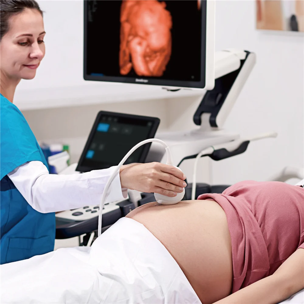 Рисунок 6 - Sonoscape S60 мобильный 3D/4D Цветной