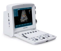 medical ultrasound instruments edan u50 portable color doppler ultrasound machine for ultrasound therapy