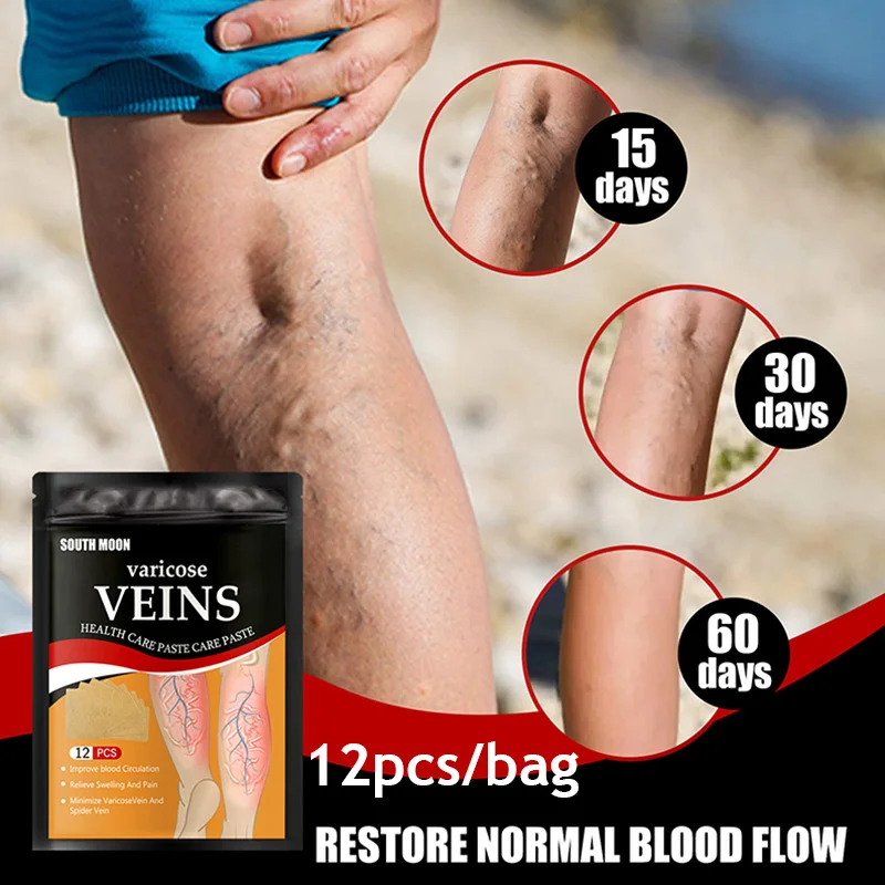 

Пластырь от варикозного расширения вен, от отеков, флебит, лечение ног, облегчение боли в ногах, восстановление нормального потока крови, 12 ц...