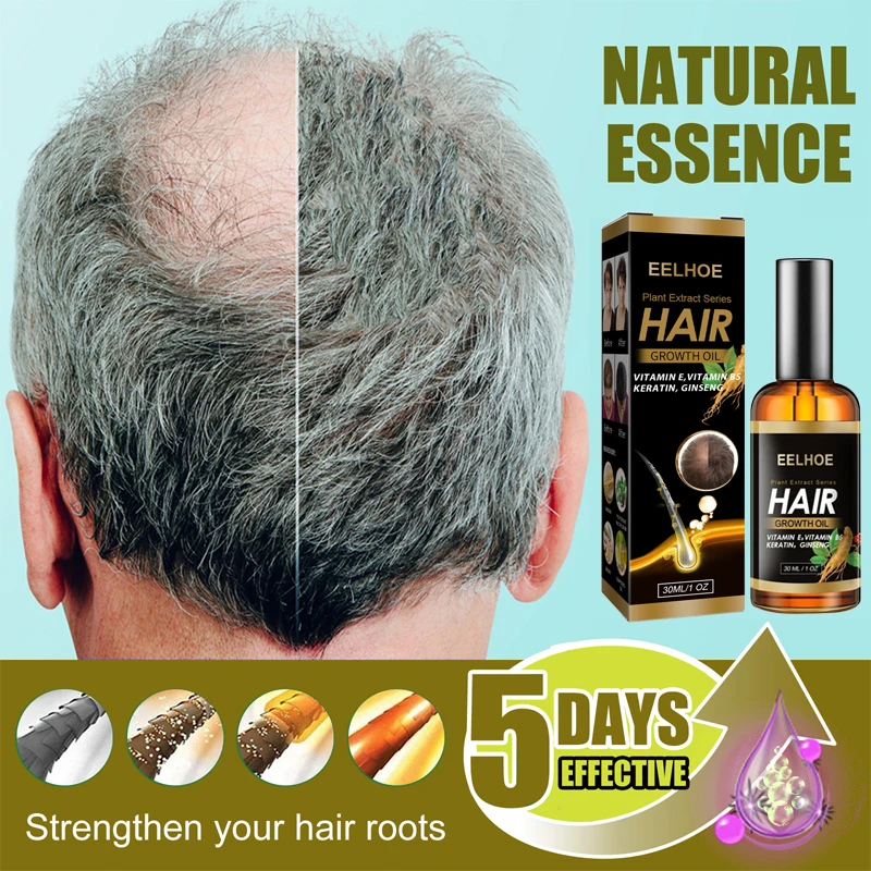 

Быстрое масло для роста волос Biotin Сыворотка для восстановления роста волос лечение истончения волос жидкость для роста волос против выпадения волос для женщин и мужчин