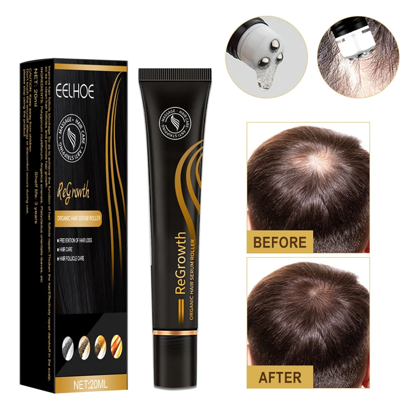 

20ML Hair Growth Oil Ginger Extract Growing Serum Prevent Hair Loss Care Scalp Massage Roller Treatment Thickener Essence 3Types