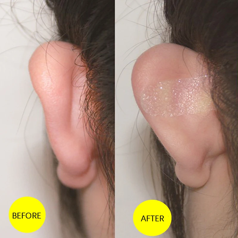 

Elf Ear Stickers Veneer Ears Become Ear Correction Vertical Stand Ear Stickers Photo Stereotypes V-Face Stickers Magic Sitcker