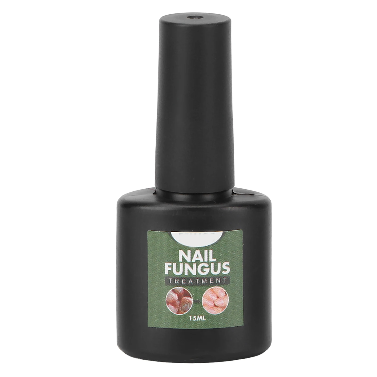 

Plant Exract Nail Repair Care Serum Mild Onychomycosis Treatment Liquid Solution for Men Women 15ml