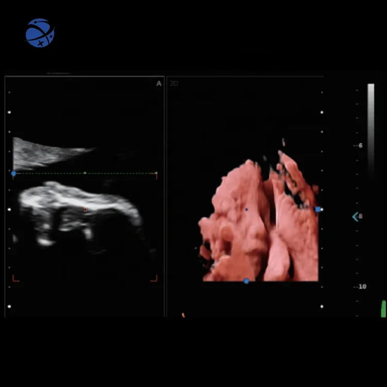 Новое поступление Цветной Допплер-сканер 3D/4D/5D тележка ультразвуковая машина для