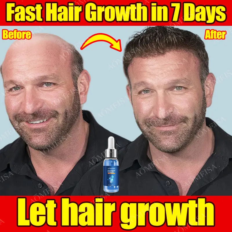 

Мощное средство для роста волос против выпадения волос против облысения быстрое восстановление волос