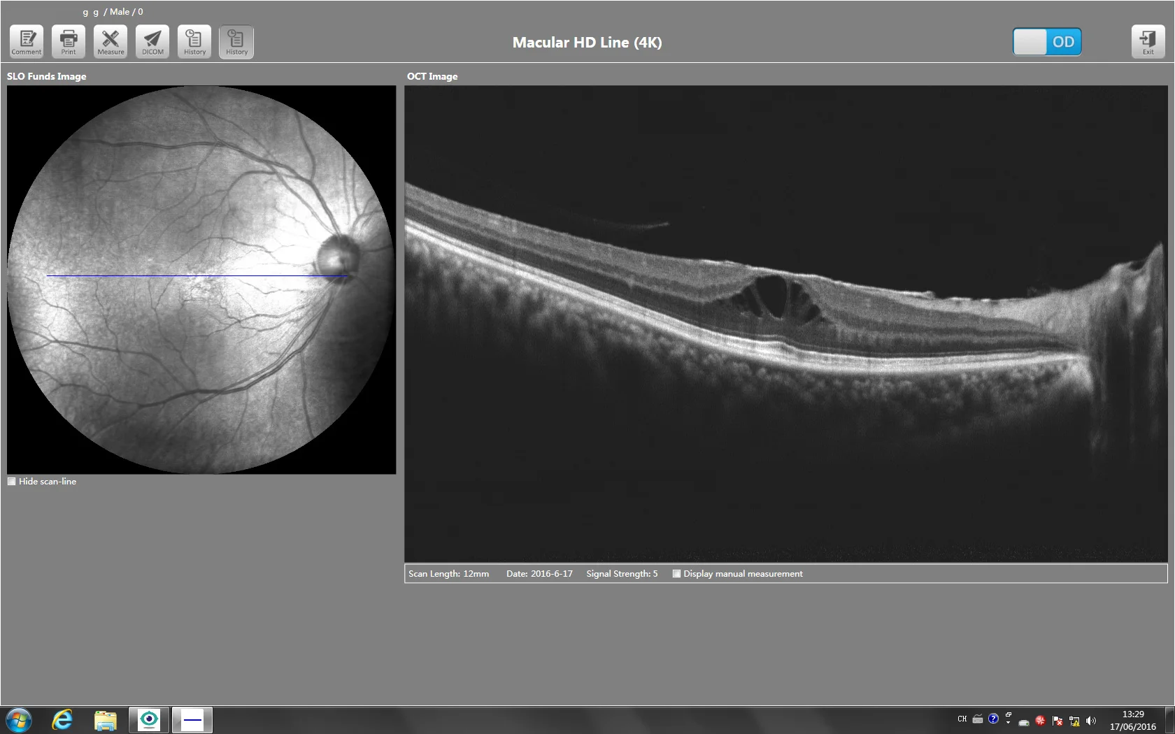 Профессиональный офтальмологический аппарат для обследования при острой