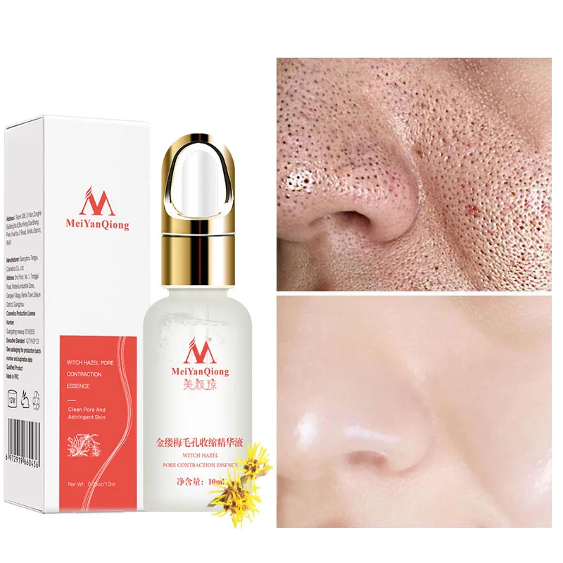 Pore Shrink Face Serum Whitening Moisturizing Essence Remove Dark Spots Improve Acne Blackheads Dry Skin Care Effectively Clean