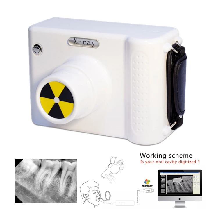 

Portable Digital dental X ray unit Model: X-122U dental x-ray Machine dental equipment scanner for dentist hospital