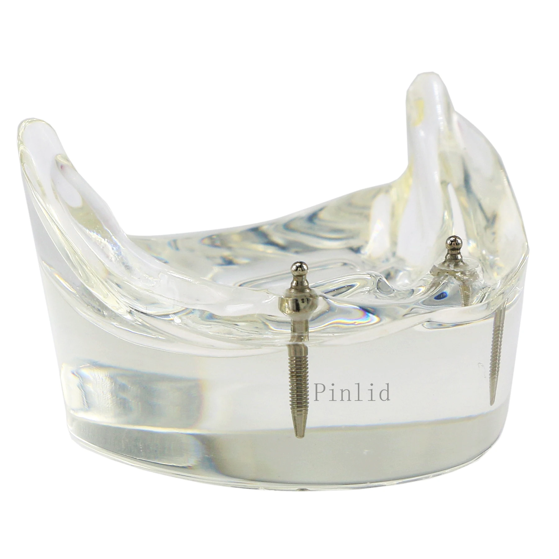 Модель зубного имплантата Overdenture Inferior 2 имплантаты для нижних зубов